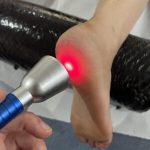 Local Specialists for High-Intensity Laser Therapy Available