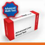Liver Blood Test Insights for Birmingham Locals