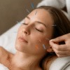 Cosmetic Acupuncture: Important Drawbacks to Consider